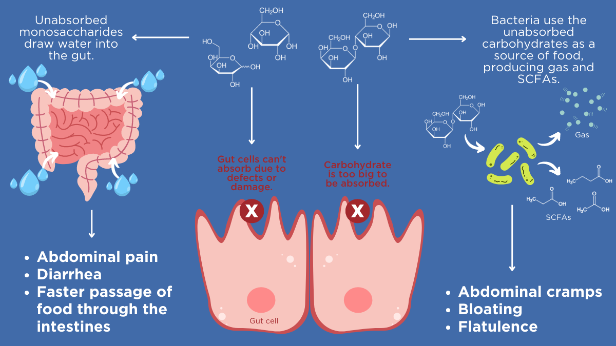 Image showing the mechanisms of carbohydrate malabsorption
