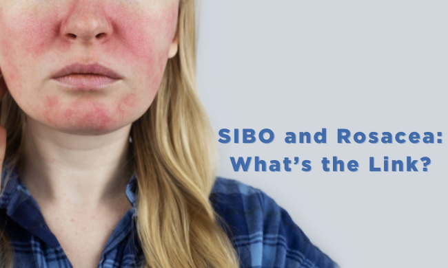sibo and rosacea