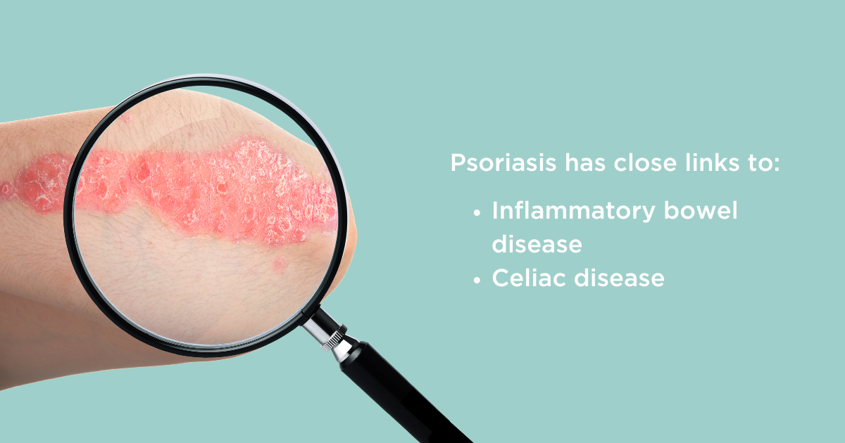 psoriasis skin
