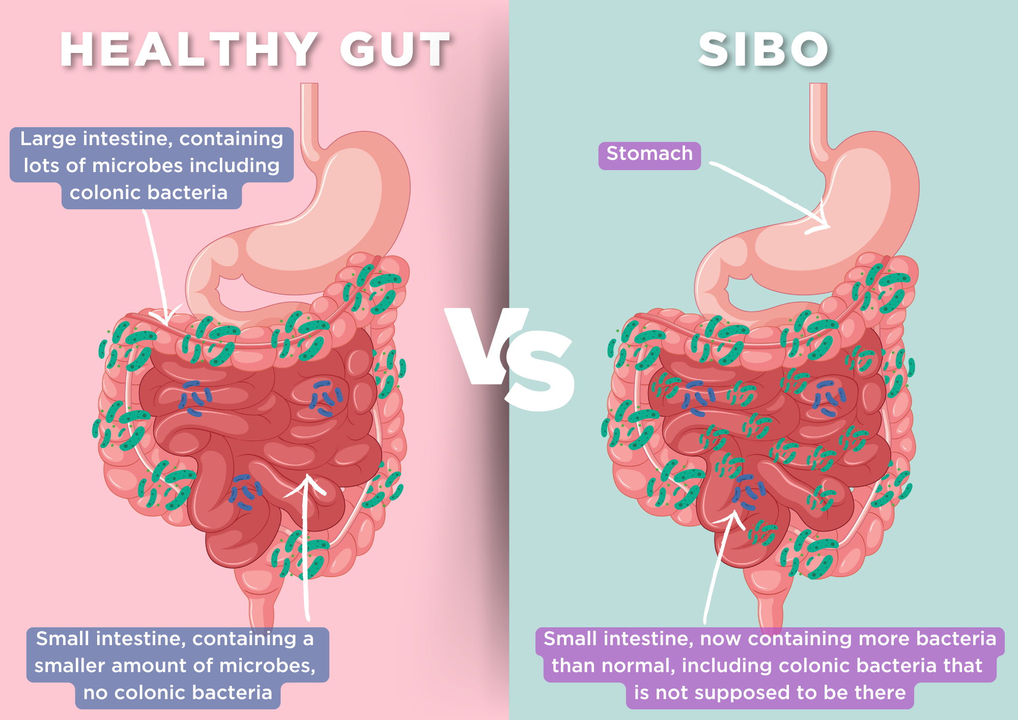 negative imo blog graphic